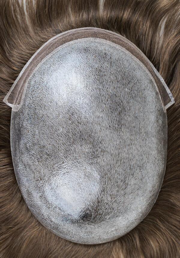  Prótesis Capilar Personalizado de Skin con Encaje Francés Frontal y Cabello Inyectado