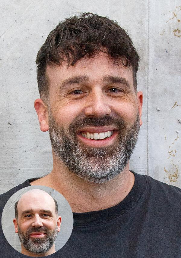 Prótesis Capilar para hombre con cabello corto precortado de cabello real