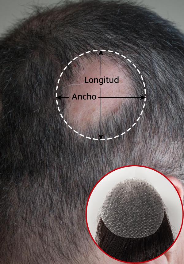 Tupé tipo Parche para hombre de cabello real e indetectable