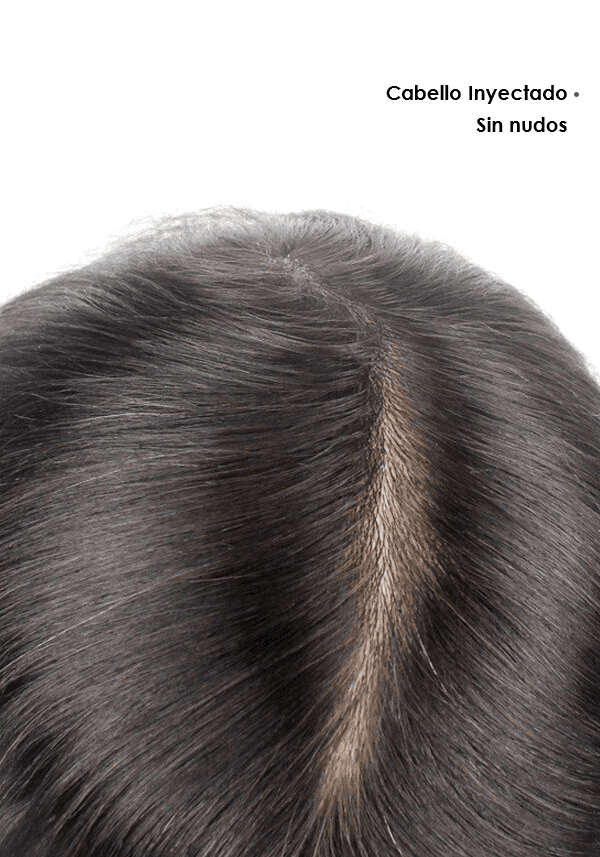Protesis Capilar Personalizado de Skin con Encaje Diamante y Encaje Frontal Francés. Línea del Cabello Realista