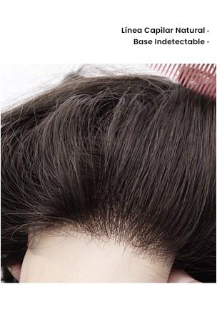 Prótesis Capilar Personalizado de Skin y Cabello V-looped y Sin Nudos