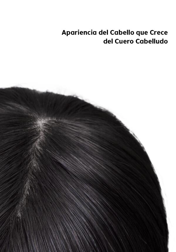 Prótesis Capilar Personalizado Encaje y Superficie de Seda. Altamente Realista