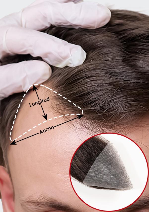 Tupé tipo Parche para hombre de cabello real para las entradas e indetectable