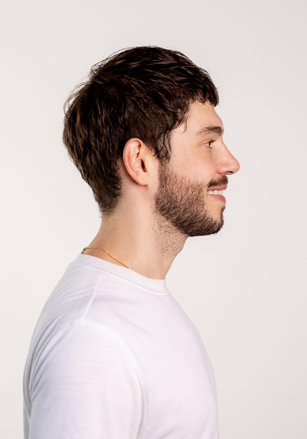Prótesis Capilar de Skin de 0.03mm con Cabello V-looped de apariencia realista