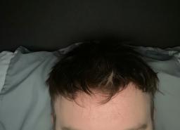 Customer wearing Lordhair gray hair system
