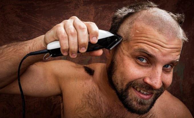 Débilitamiento y Pérdida de Cabello: Si Me Rapo ¿Puede Volver a Crecer Sano el Cabello?