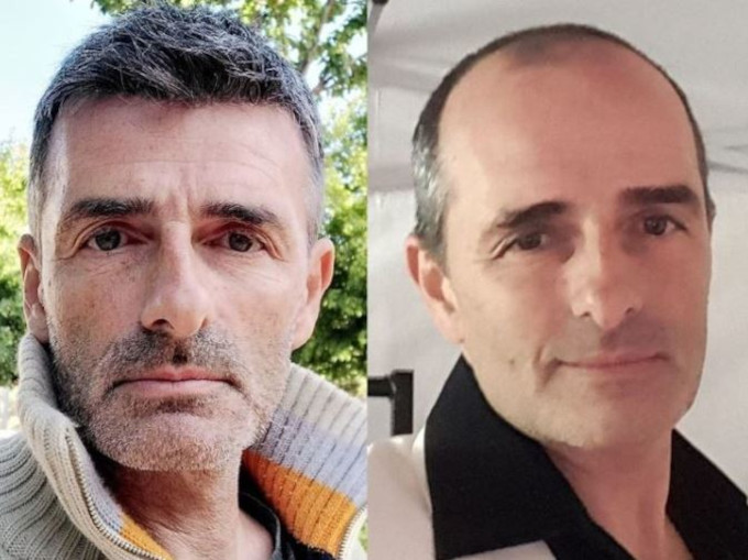 antes y despues hombre maduro con protesis capilar