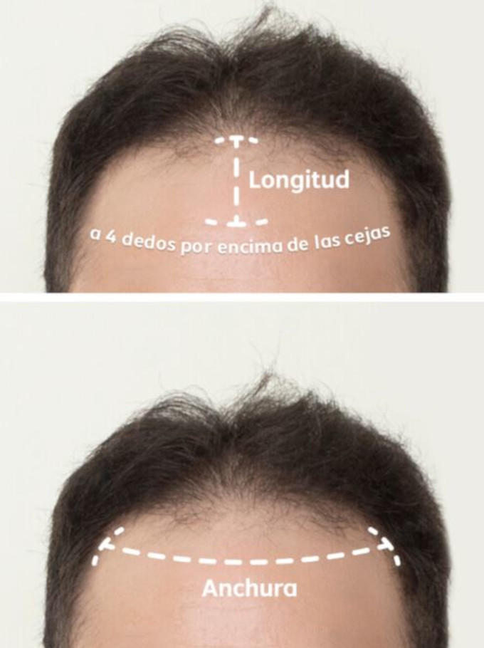 como medir una protesis capilar frontal para hombre