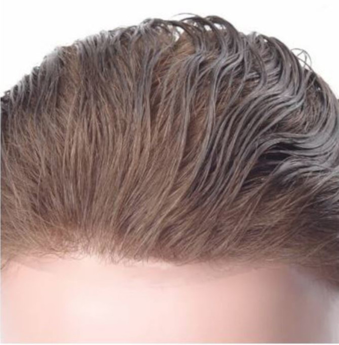 densidad de cabello en prótesis capilares