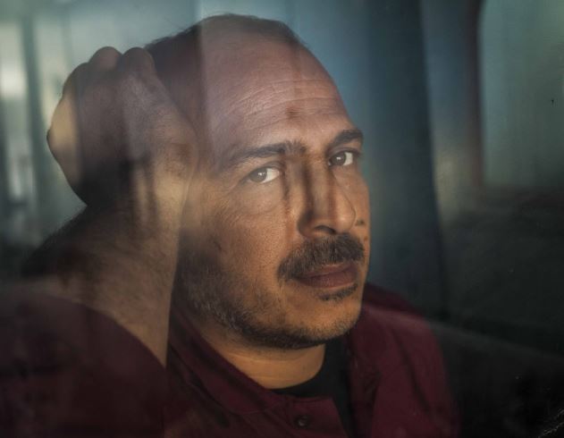 El hombre puede sentir ansiedad y estres al enfrentar la calvicie