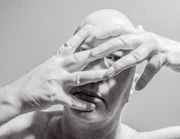 La percepción de uno mismo sobre la calvicie puede cambiar de manera negativa