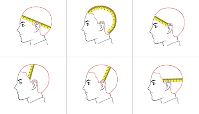 Pelucas personalizadas para niños con alopecia