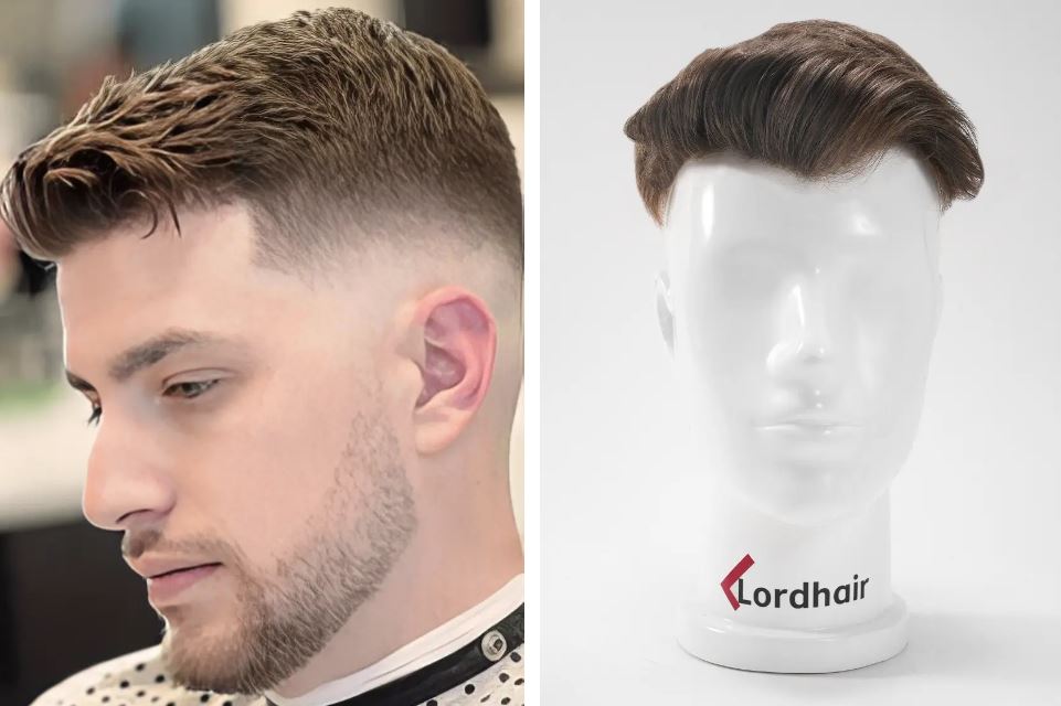 Prótesis capilar indetectable como opción segura para la pérdida de cabello