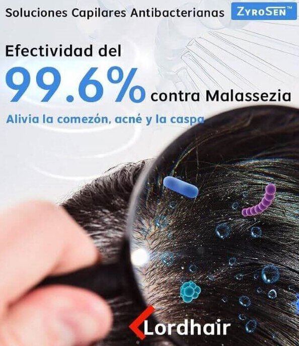Prótesis capilares antibacterianas que alivian y protegen el cuero cabelludo
