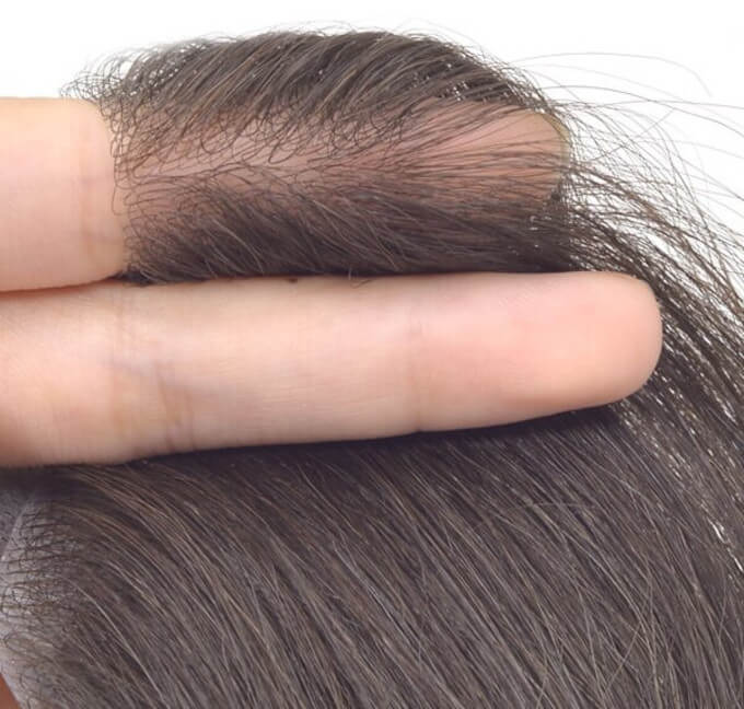 Densidad de cabello en protesis capilar frontal