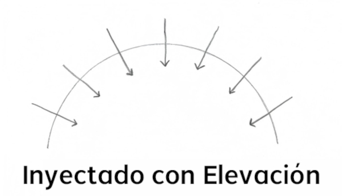 Prótesis capilar de inyección elevada