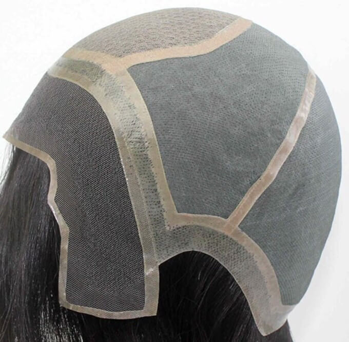 Prótesis Capilar Médica y Oncológica para Pérdida de Cabello