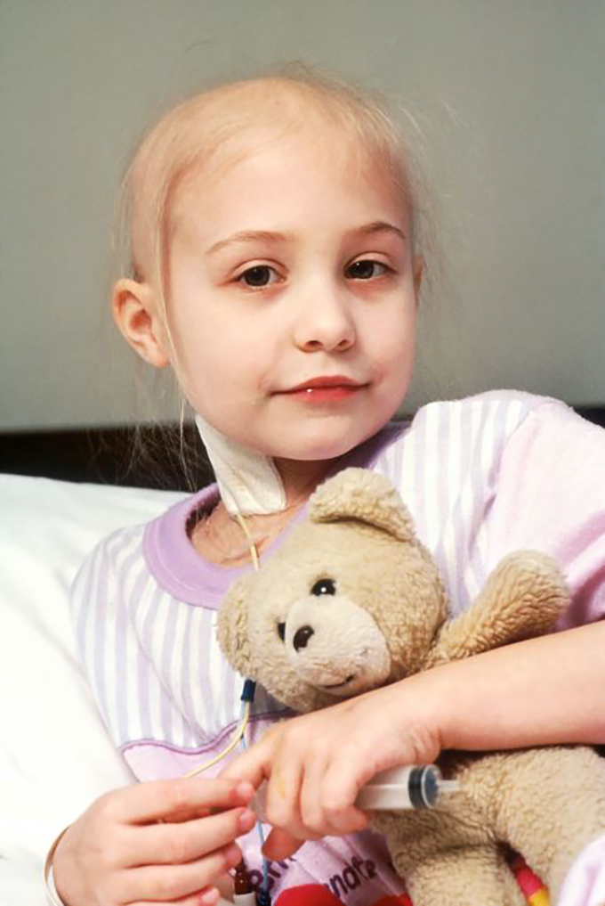 alopecia en niños y pelucas especiales para ellos