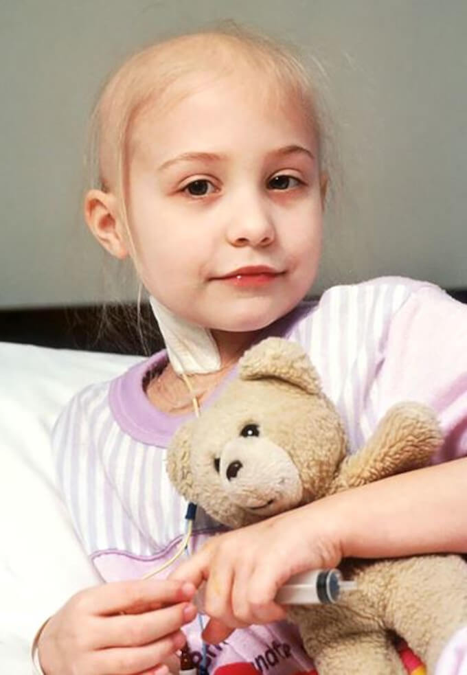 alopecia en niños y pelucas especiales para ellos