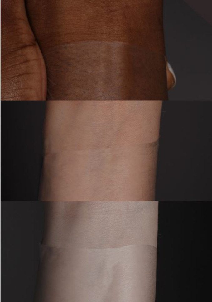 skin delgado realista en protesis capilares