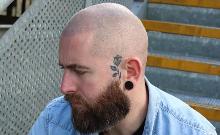 tratamiento para la perdida de cabello sin cirugia