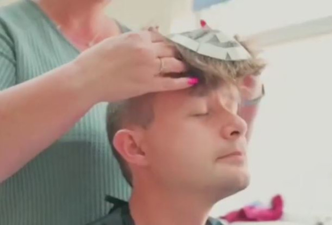 sugerencias practicas en la colocacion de protesis capilares