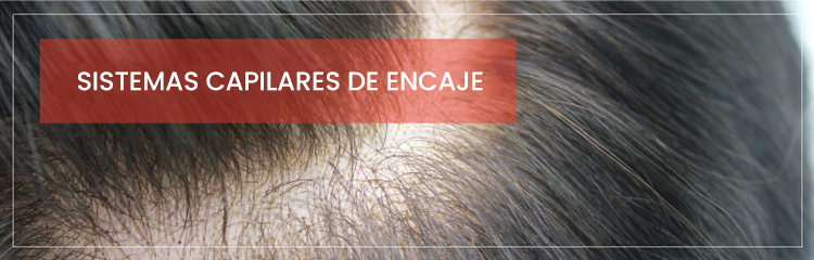 Prótesis Capilares de Encaje Prótesis Capilares de Encaje
