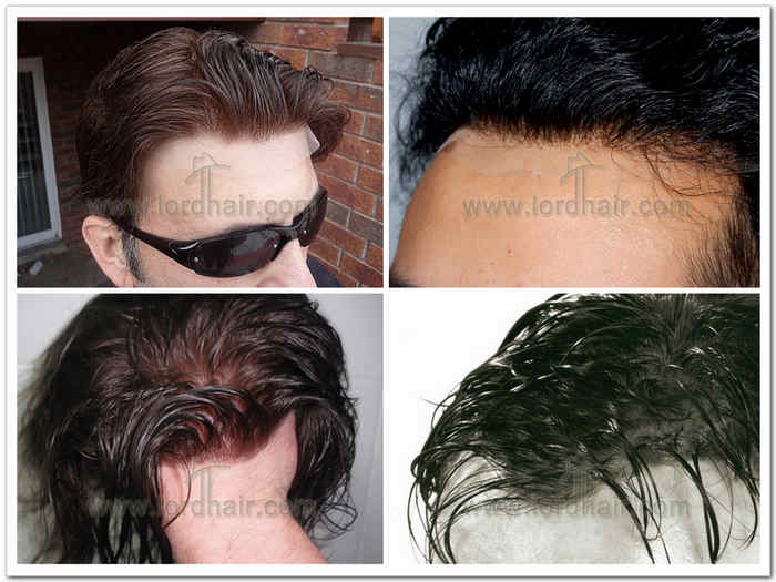 hair replacement non bleach knots