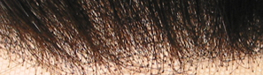 hair replacement non bleach knots