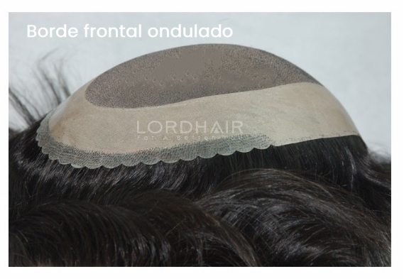 borde-scalloped