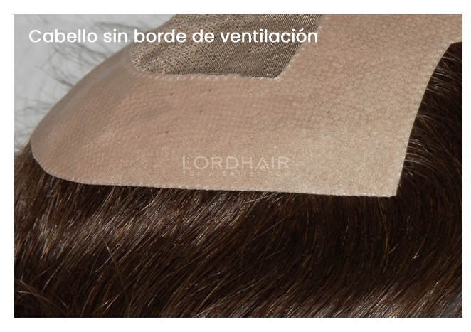 sin-ventilación